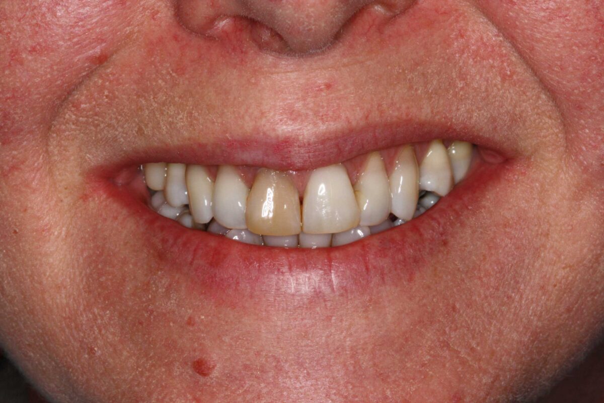 Smile Mclean Dentistry Smile Mclean Dentistry
