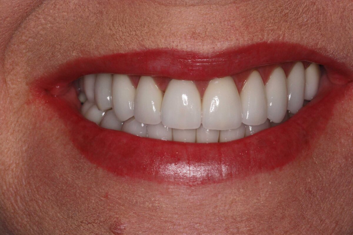 Smile Mclean Dentistry Smile Mclean Dentistry