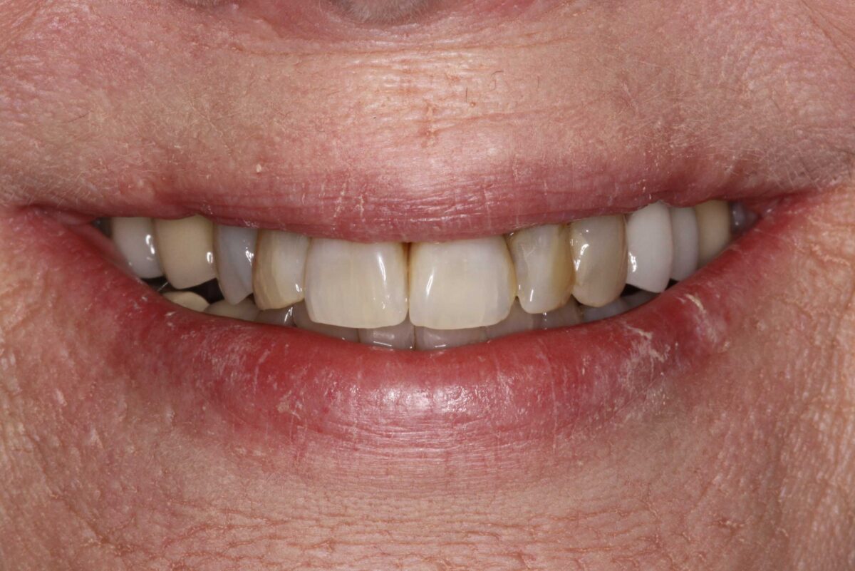 Smile Mclean Dentistry Smile Mclean Dentistry