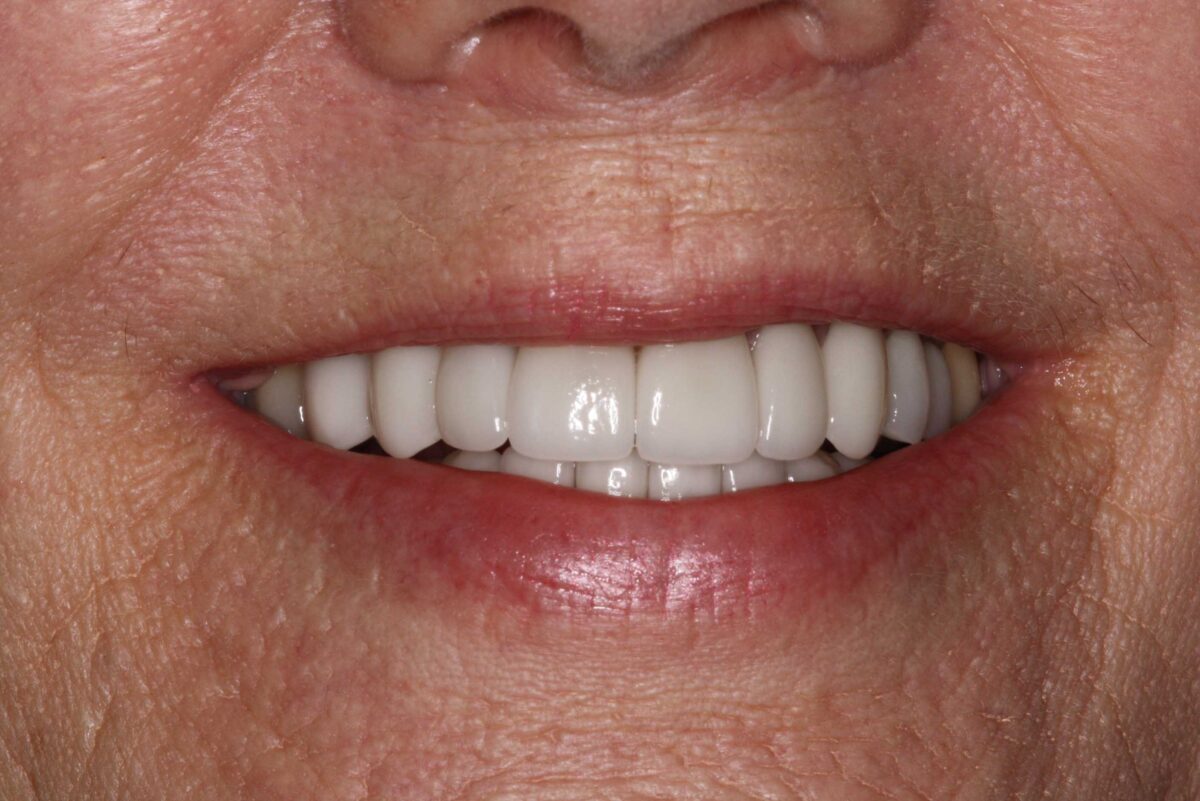 Smile Mclean Dentistry Smile Mclean Dentistry