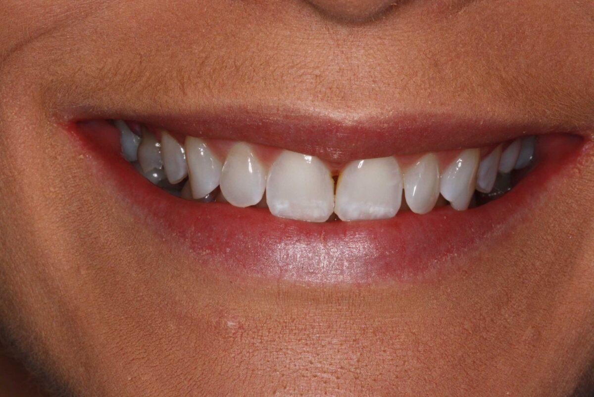 Smile Mclean Dentistry Smile Mclean Dentistry