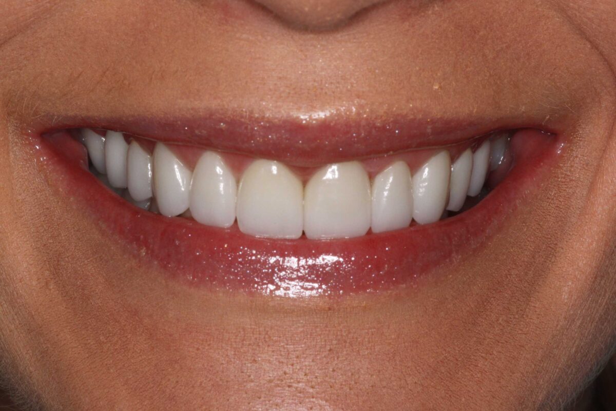 Smile Mclean Dentistry Smile Mclean Dentistry