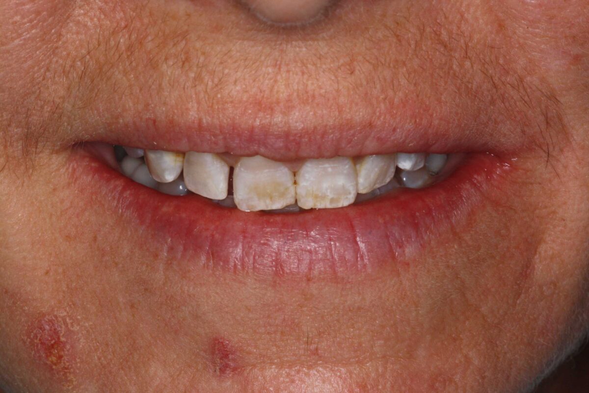 Smile Mclean Dentistry Smile Mclean Dentistry