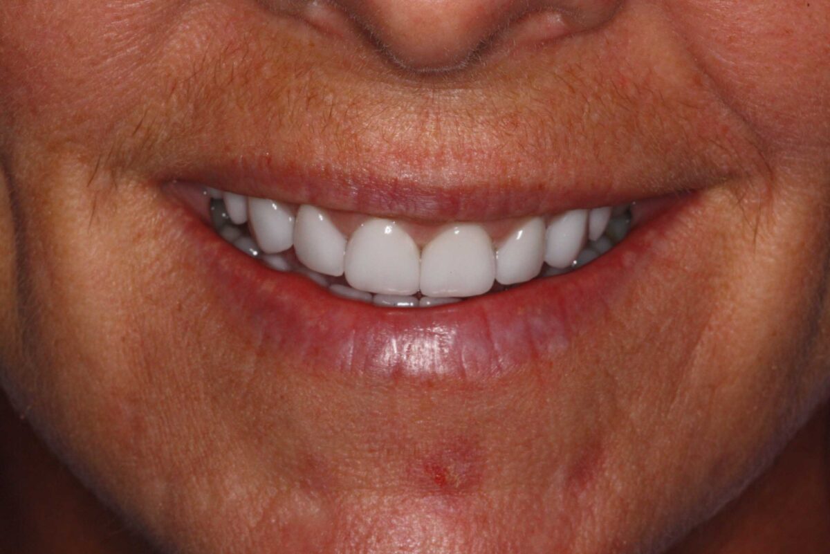 Smile Mclean Dentistry Smile Mclean Dentistry