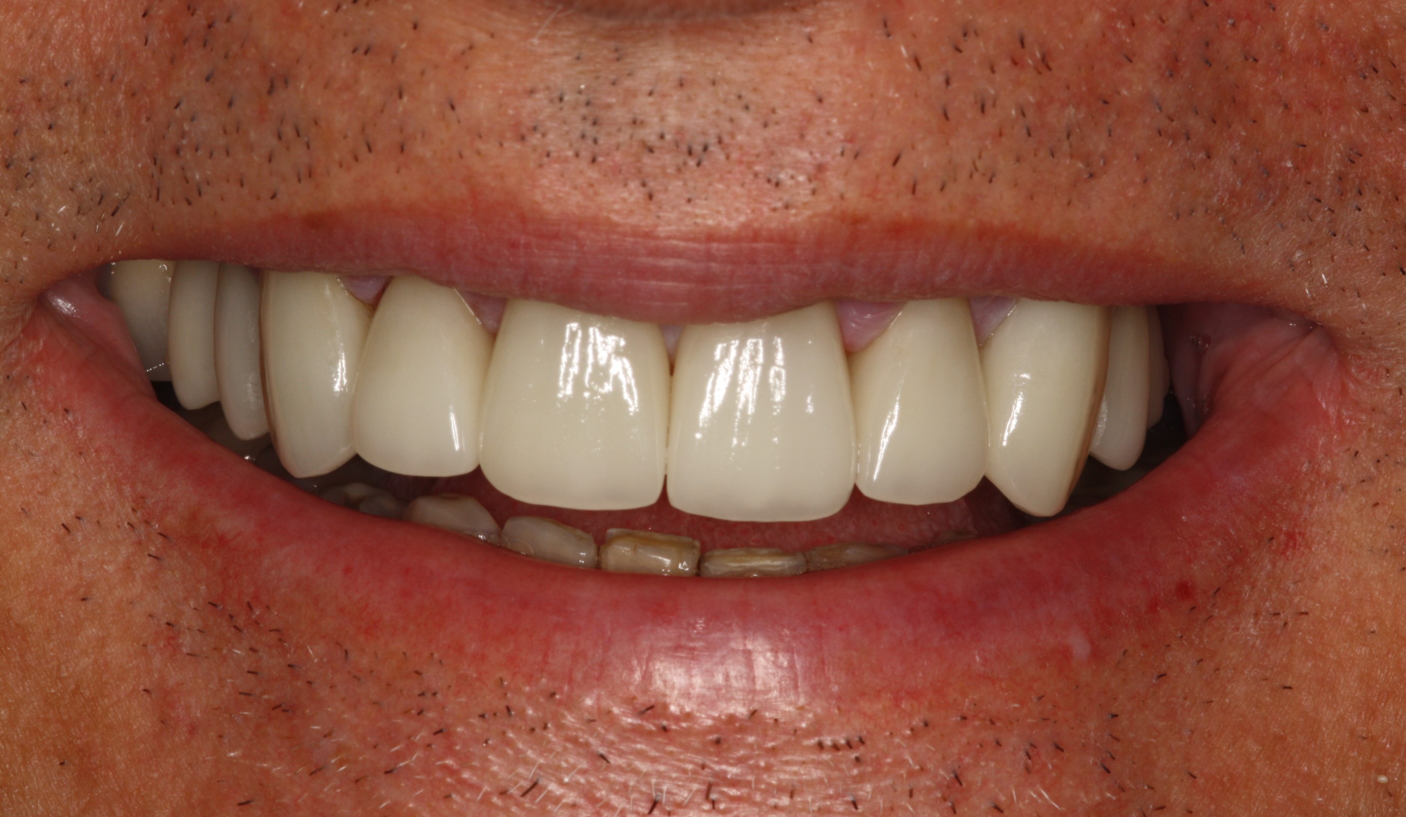 Smile Mclean Dentistry Smile Mclean Dentistry