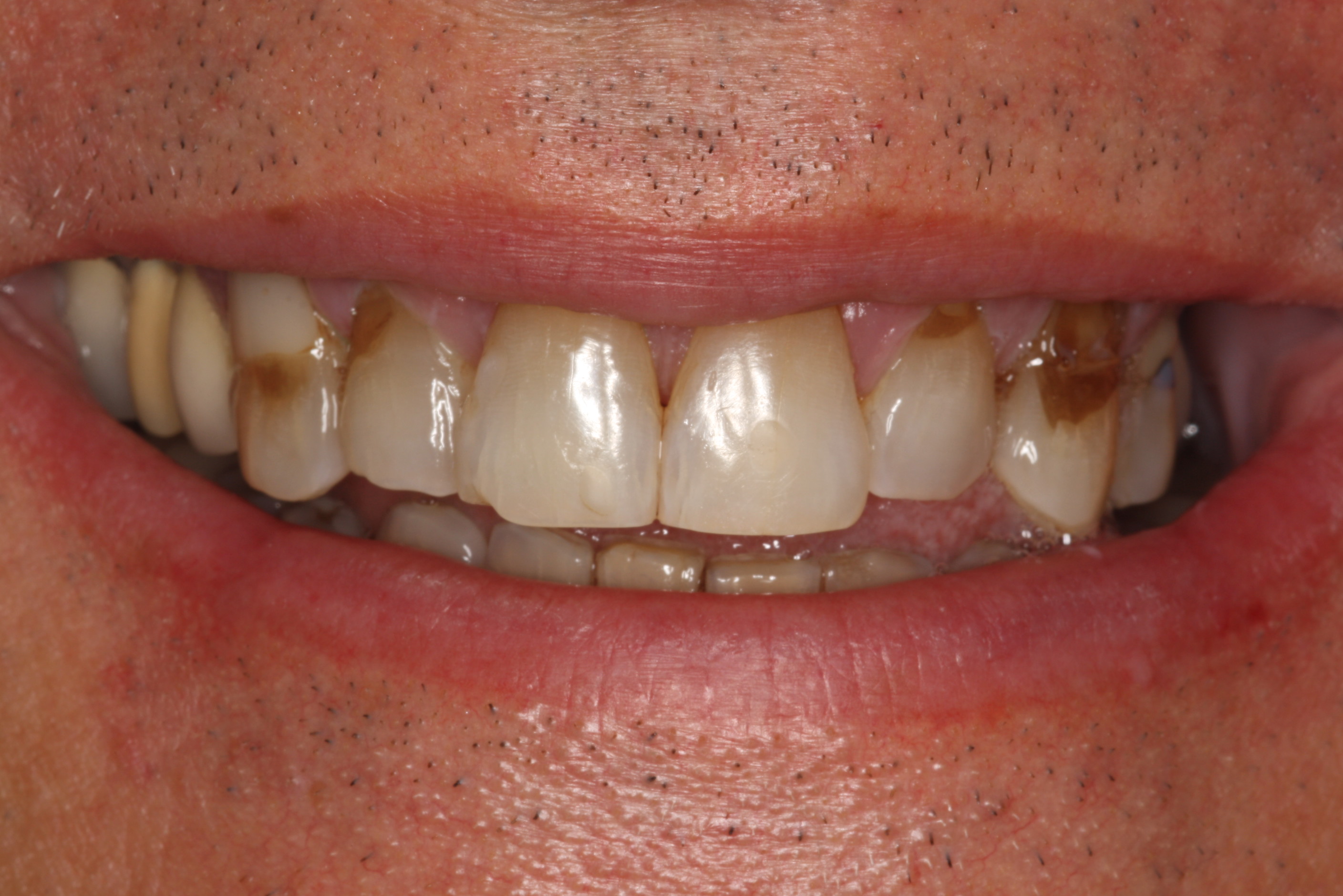 Smile Mclean Dentistry Smile Mclean Dentistry