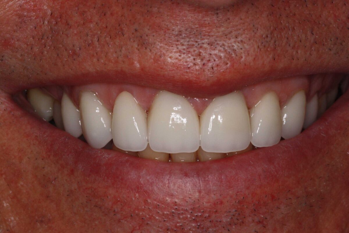 Smile Mclean Dentistry Smile Mclean Dentistry
