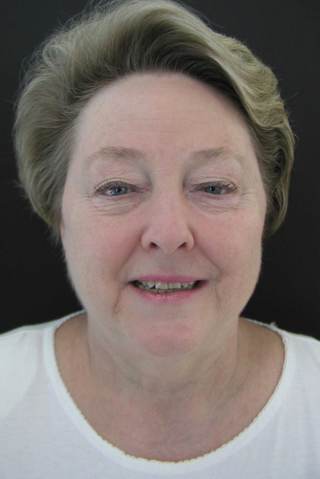 Smile Mclean Dentistry Smile Mclean Dentistry