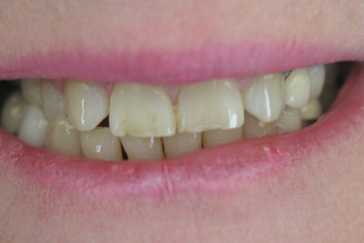 Smile Mclean Dentistry Smile Mclean Dentistry