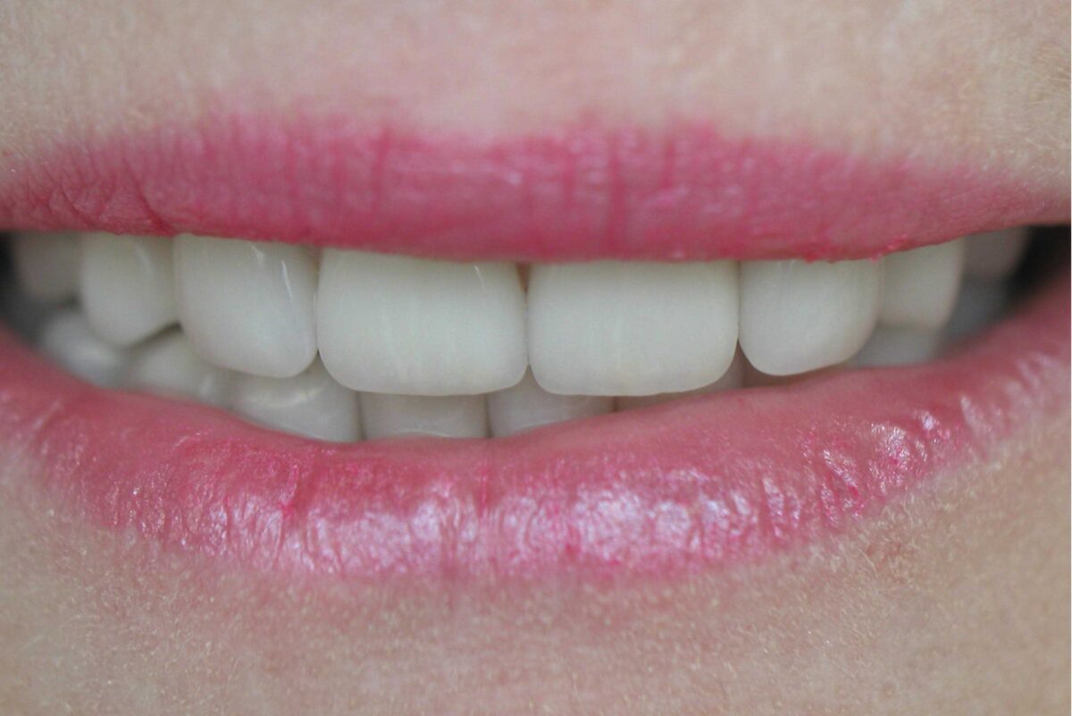 Smile Mclean Dentistry Smile Mclean Dentistry