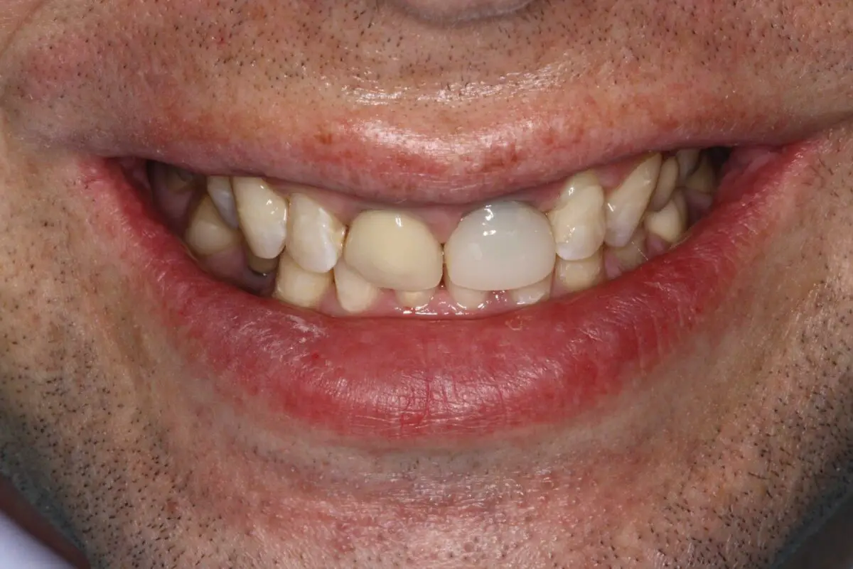 Smile Mclean Dentistry Smile Mclean Dentistry