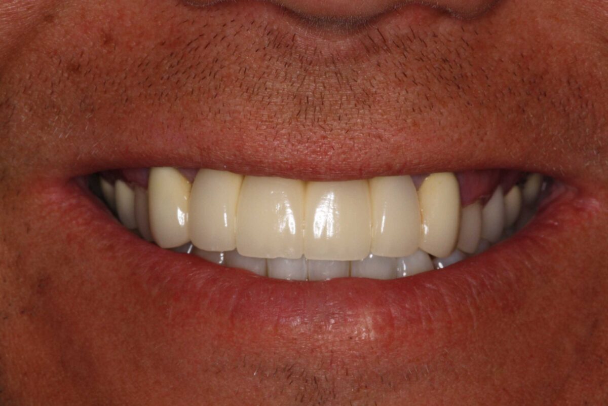 Smile Mclean Dentistry Smile Mclean Dentistry