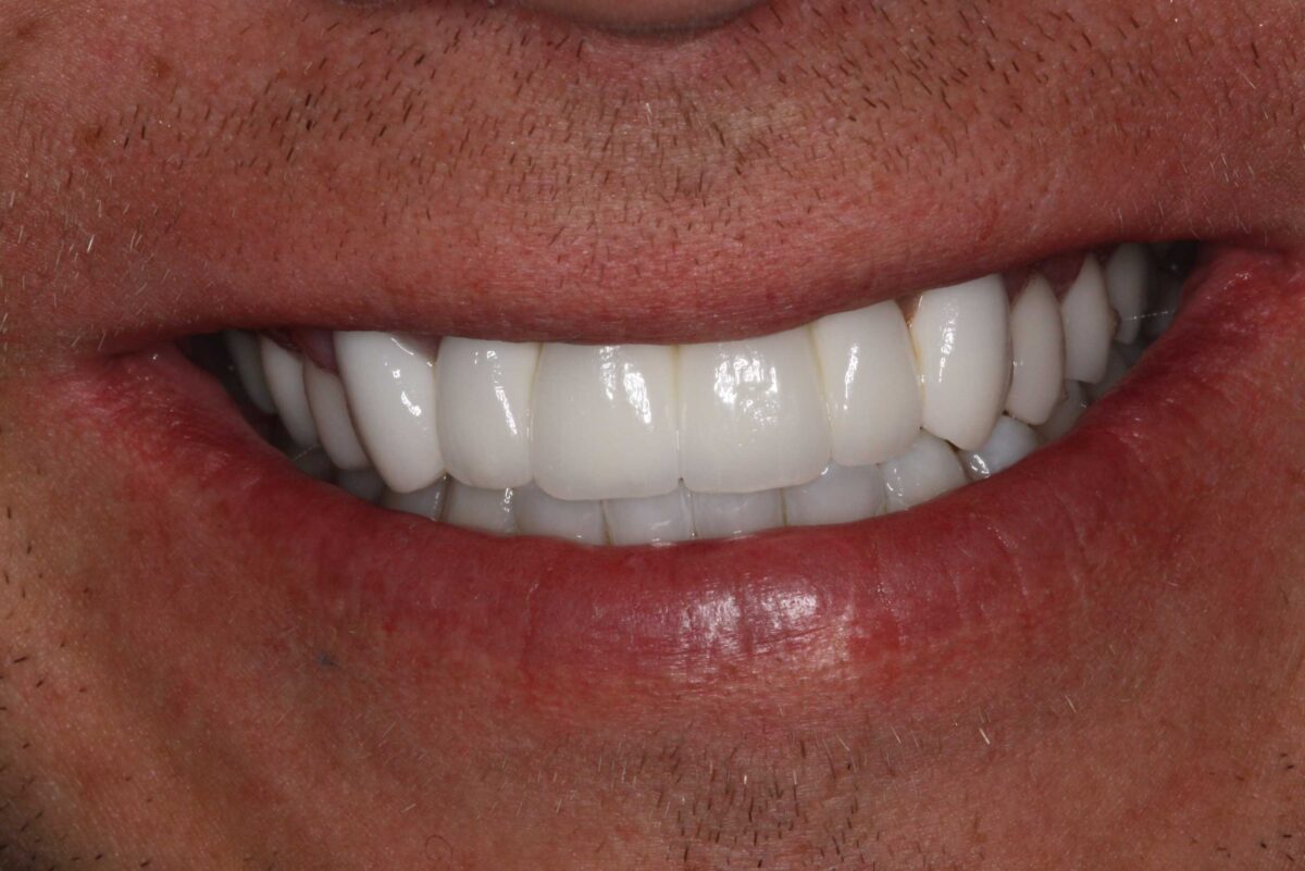Smile Mclean Dentistry Smile Mclean Dentistry
