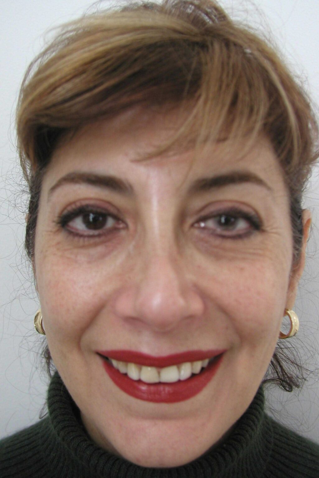 Smile Mclean Dentistry Smile Mclean Dentistry