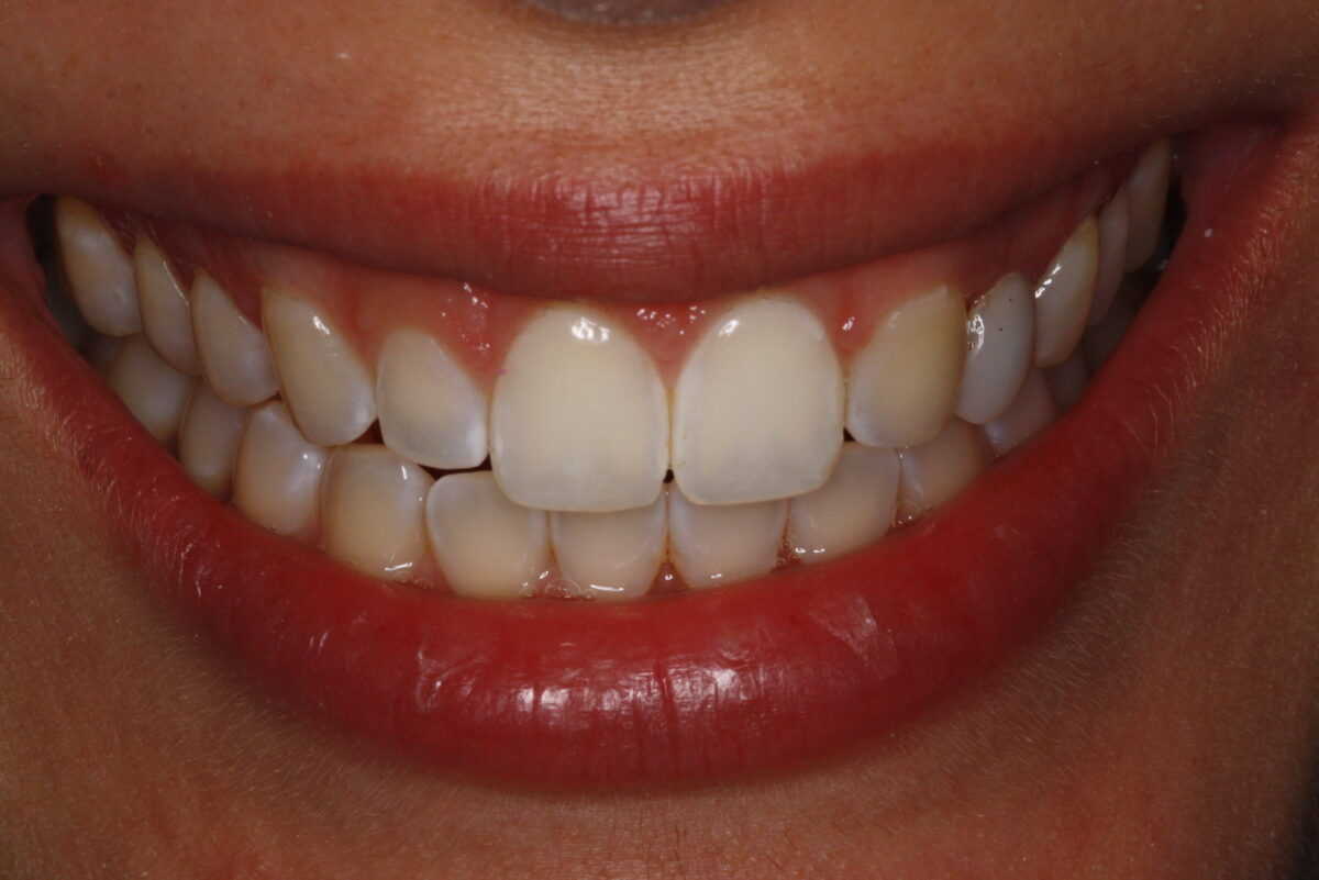 Smile Mclean Dentistry Smile Mclean Dentistry