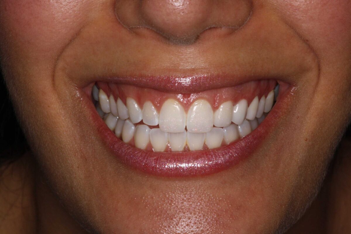 Smile Mclean Dentistry Smile Mclean Dentistry