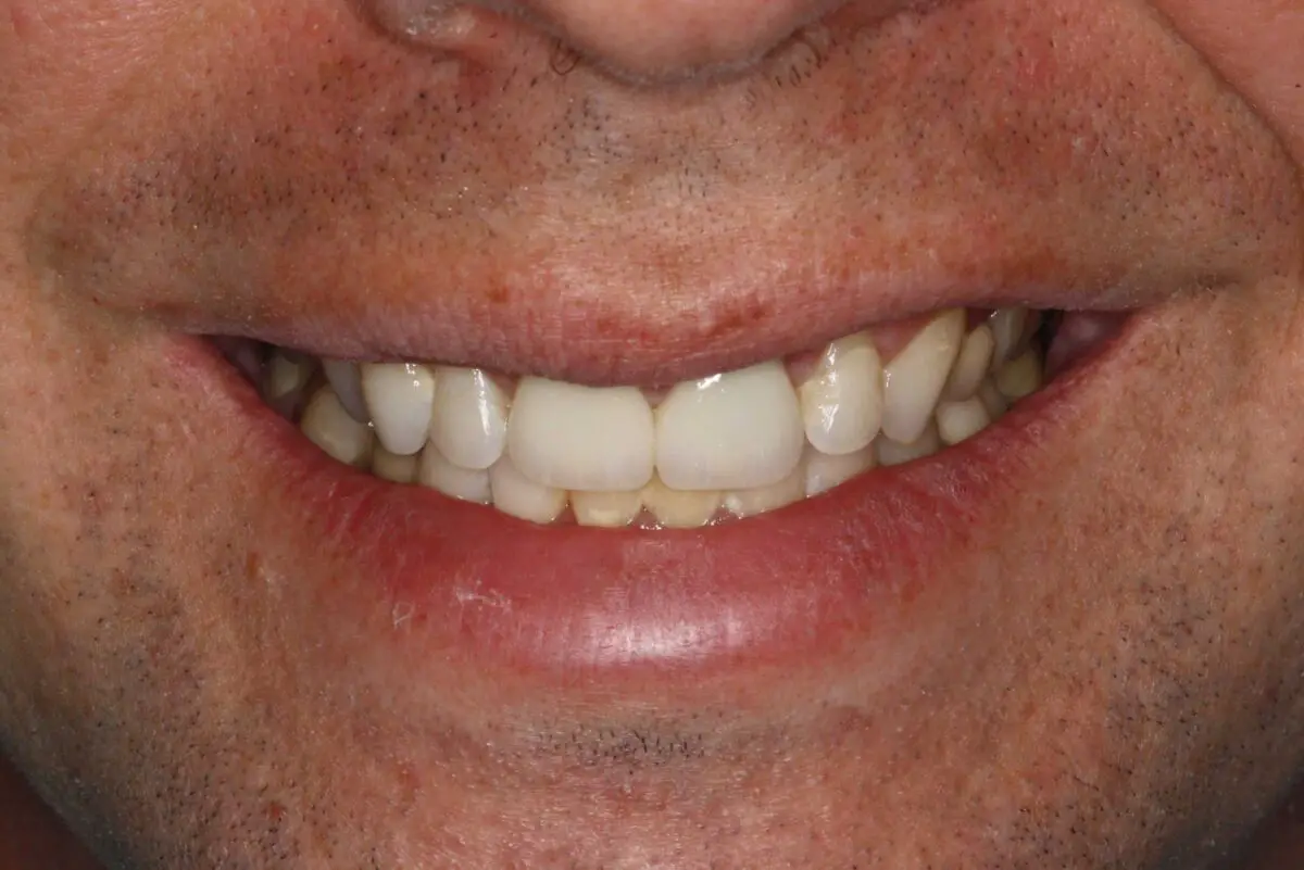 Smile Mclean Dentistry Smile Mclean Dentistry