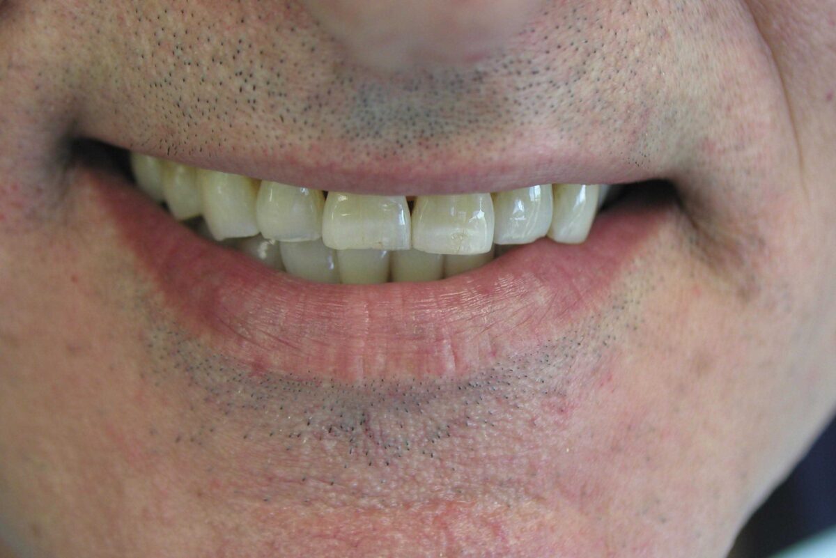 Smile Mclean Dentistry Smile Mclean Dentistry