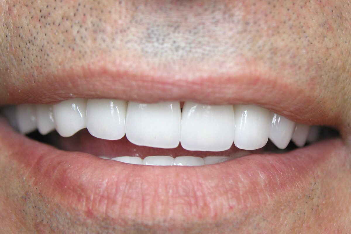 Smile Mclean Dentistry Smile Mclean Dentistry