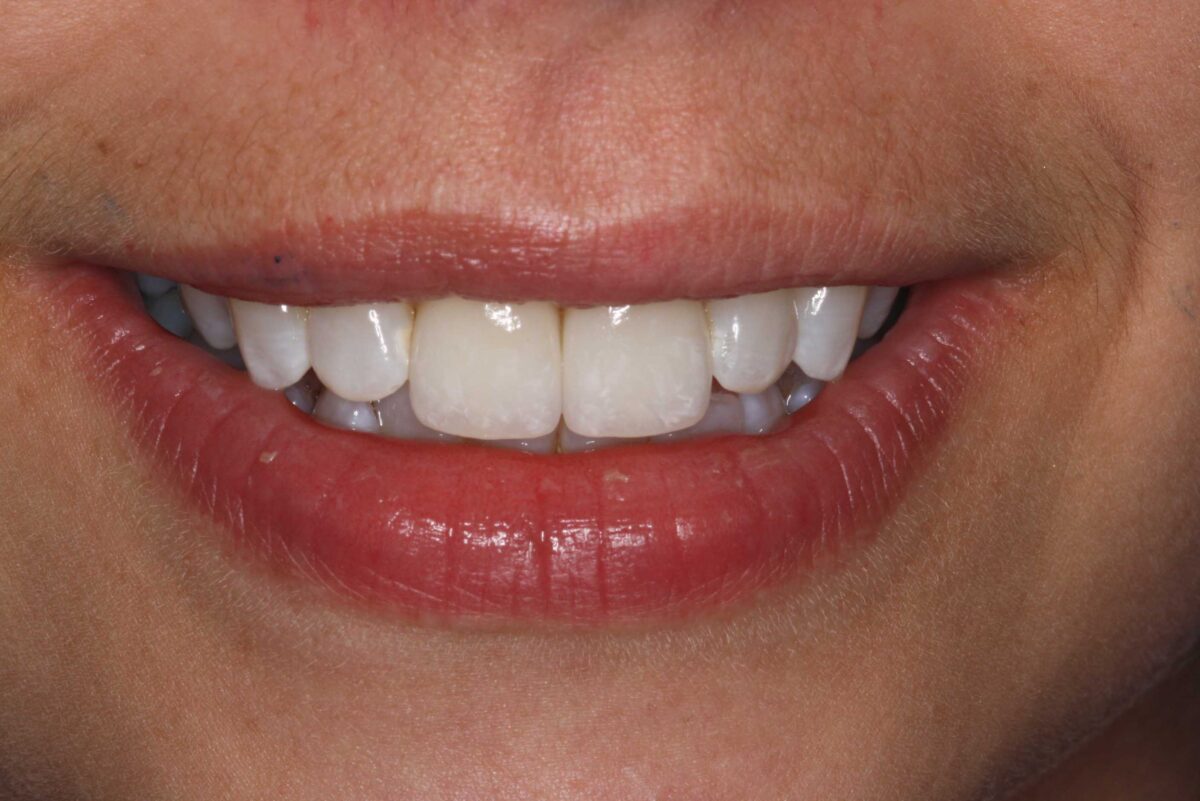 Smile Mclean Dentistry Smile Mclean Dentistry